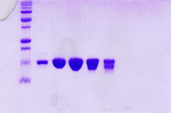 smh A10 A11 A12 B1 B2 Obr. 5.6 Vizualizovaný gel po 15% (w/v) SDS PAGE provedené po gelové permeační chromatografii.