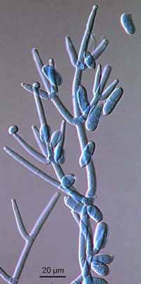 Anamorfy konidiogenní buňka konidie konidiofor Cladobotryum mycophilum