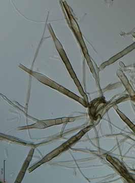 Anamorfy konidiogenní buňka konidiofor konidie vegetativní mycelium
