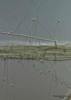 Anamorfy konidiogenní buňka vegetativní mycelium konidie