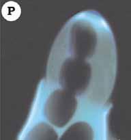 Pezizomycotina Dothideomycetes Pleosporales - plodnice ve stromatu, vřecka bitunikátní, askospory