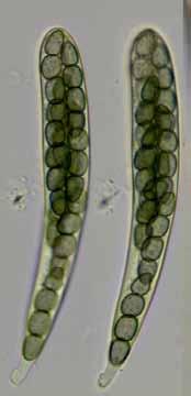 bezobratlých) - Cochliobolus, Pleospora, Venturia (teleomorfy) - Alternaria, Drechslera (anamorfy)