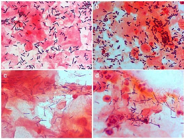 Lactobacillus story zdravá vaginální mikrobiota 1 druh dominuje Lactobacillus acidophilus komplex L. crispatus L. iners L. gasseri L. jensenii L.