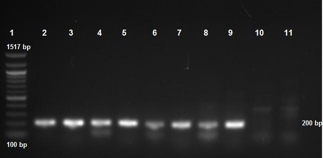 UTB ve Zlíně, Fakulta technologická 56 Po proběhnutí PCR byl obsah mikrozkumavky opět nanesen na 1% agarosový gel, a výsledek je vyfocen na obrázku (Obr. 13).