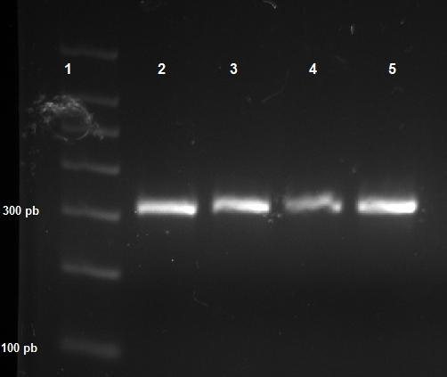 UTB ve Zlíně, Fakulta technologická 59 byla volena na základě Tm jednotlivých primerů. Podmínky PCR jsou uvedeny v Tab. 10 následný výsledek elektroforézy v 1% agarosovém gelu pak znázorňuje Obr. 16.