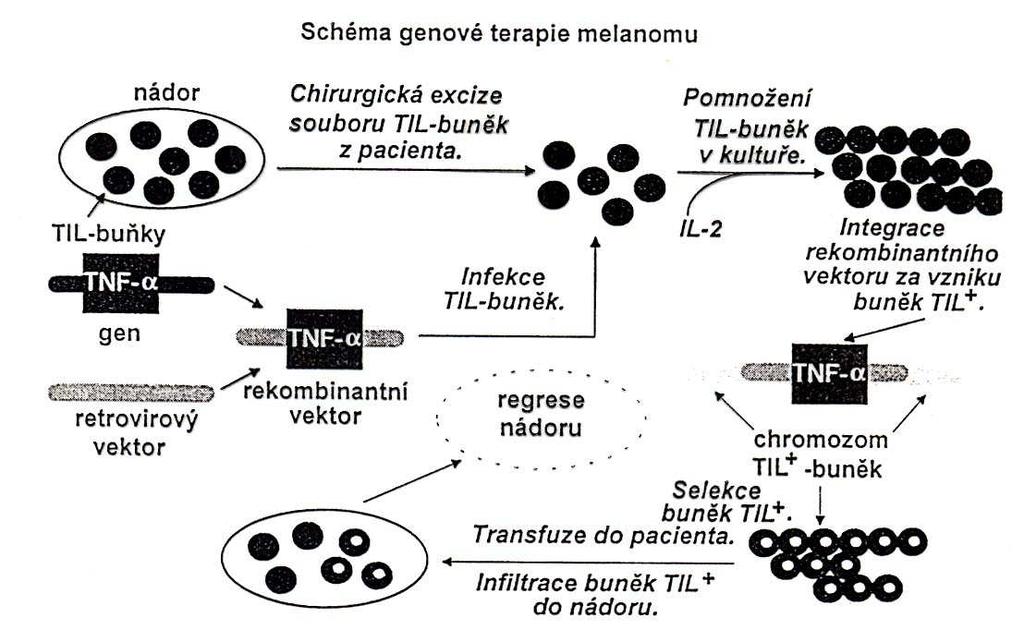 Schéma genové terapie melanomu TIL = tumor