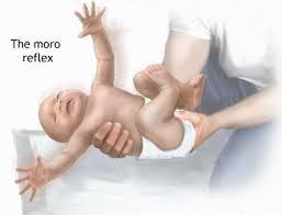 Moro reflex Norma