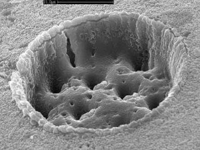 obliquiloculata S. Eggins et al.