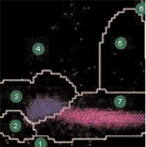 ) 4 Lymphocytes and Basophils 4 Basophils 5 Large Unstained Cells 5 Baso Suspect 6 Monocytes 6 Saturation 7 Neutrophils 7 Polymorphonuclear WBCs (Neu., Eo.