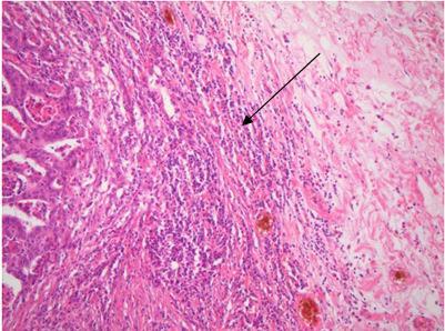 hematoxylin-eosin) Obrázek 13 -