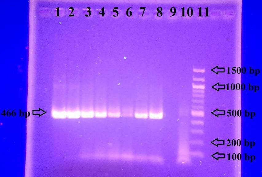 B h 1. 2. 3. 4. 5. 6. 7. 8. 9. 10. 11. Detekce produktu PCR (466 bp) E. coli 100 ng/µl +++ E. coli 10 ng/µl +++ E. coli 1 ng/µl + E. coli 1 ng/µl +++ E. coli 100 pg/µl +++ E. coli 10 pg/µl Lbc.