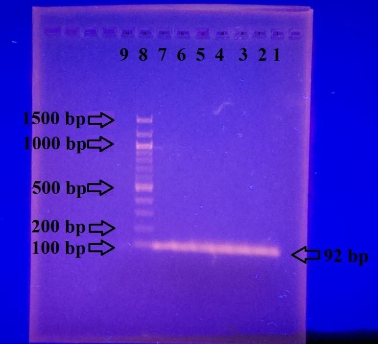 Přítomnost specifického produktu PCR pro doménu Bacteria o velikosti 466 bp byla prokázána ve všech vzorcích. Tím byla ve všech vzorcích potvrzena přítomnost bakteriální DNA. 5.3.
