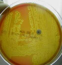 VL-anaeróbne baktérie HF-Haemophilus