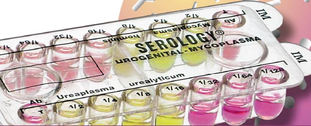KULTIVOVATELNÉ MO, DETEKCE JEJICH NUKLEOVÝCH KYSELIN NEPŘÍMÉ METODY: SÉROLOGICKÉ A
