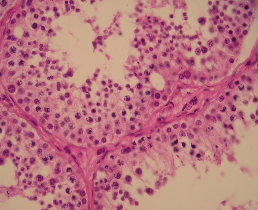 Testes Tubuli seminiferri concorti a rete testis Zárodečný neboli