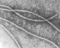 Virus