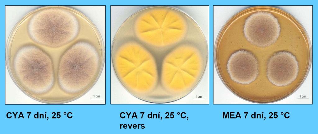 Aspergillus terreus kolonie rychle rostoucí, okrové, sametové, roste i při 37 C výskyt na potravinách a v prostředí budov, bývá izolován i