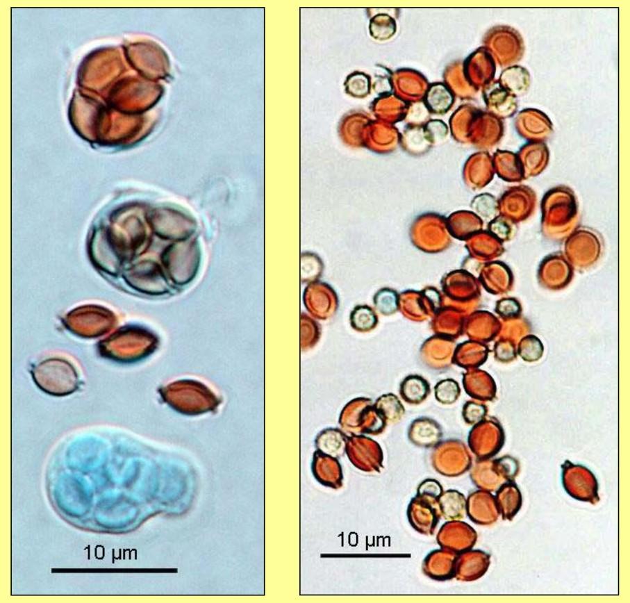 Aspergillus nidulans konidiofory biseriátní, hladké, nahnědlé s