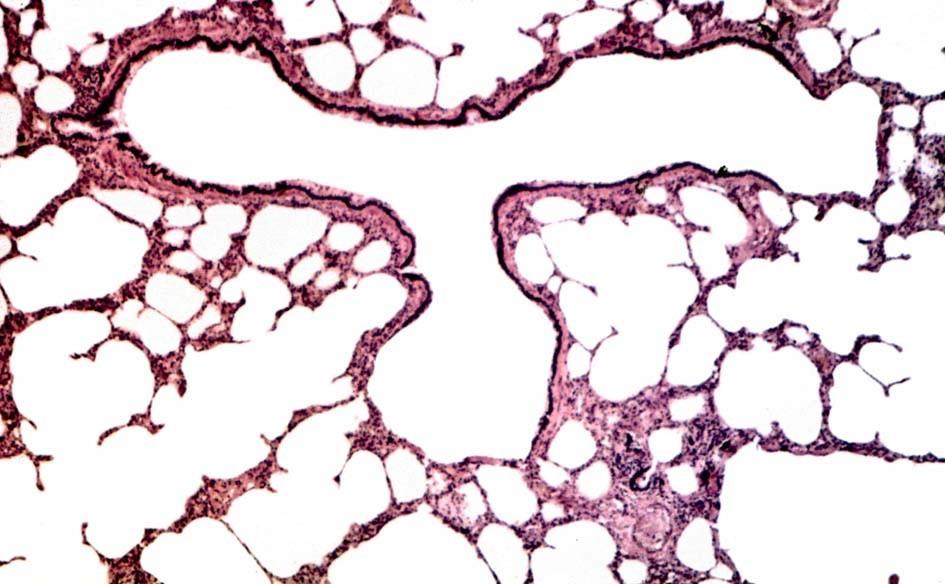 bronchiolus terminalis b.