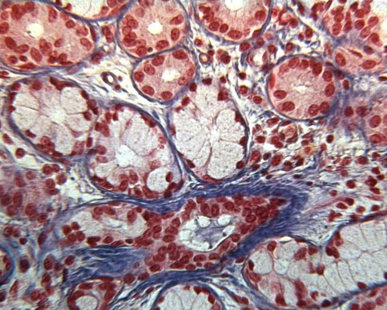 Sliznice Epitel: víceřadý cylindrický s řasinkami a pohárkovými buňkami lamina propria mucosae (řídké kolag.