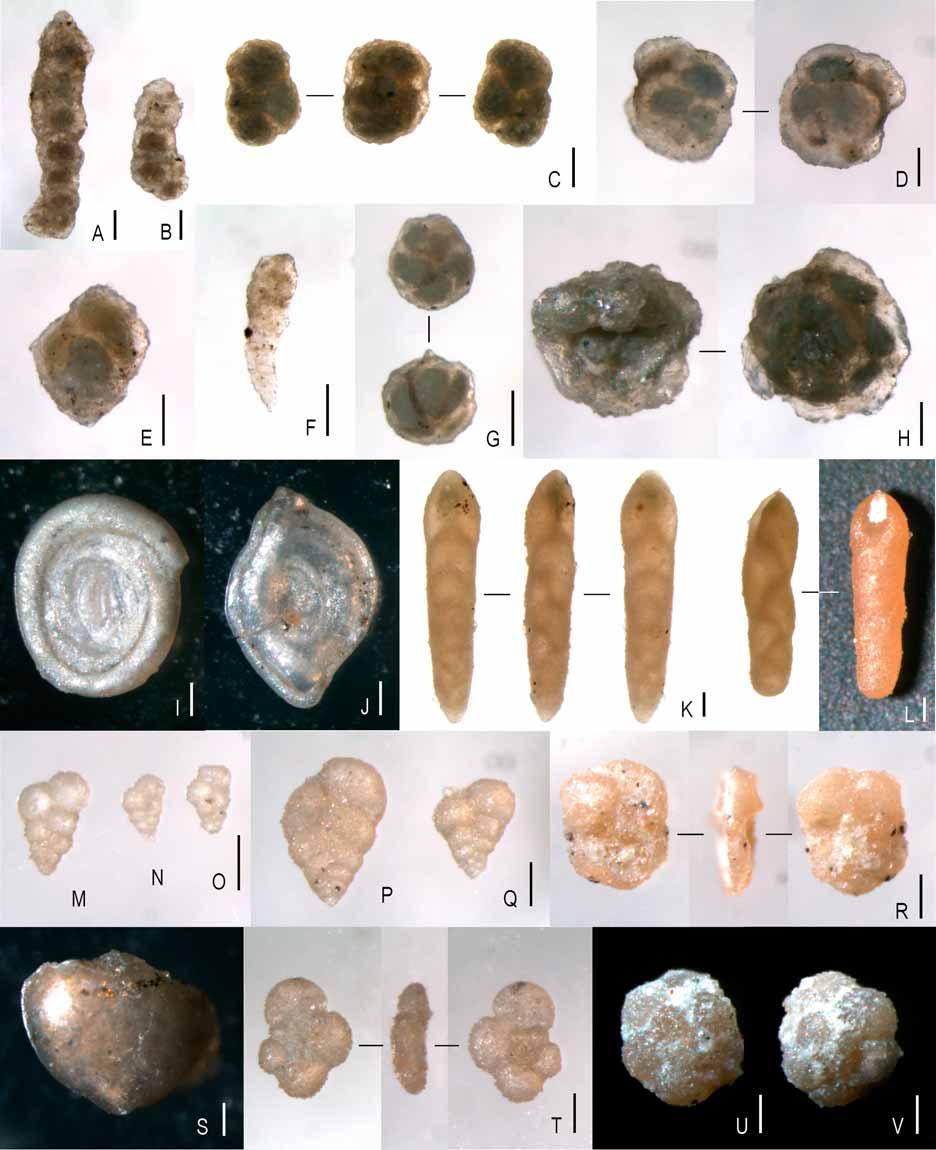 Mezozoikum Obr. 2: Význačné druhy foraminifer z křídy podslezské jednotky v Kopytné: A, B Bulbobaculites problematicus (Neagu), MB129D; C Adercotryma cf.