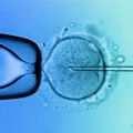 2.1.1.1. Oplození oocytů ve zkumavce Klasická a nejjednodušší metoda umělého oplození spočívá v přidání spočítaného množství spermií do zkumavky k oocytům.