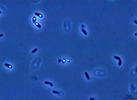 Aktuální mikrobiologická témata prionové choroby