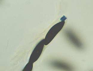 prstenec Neurospora