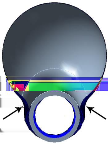 Obrázek 5.6: Rozdíl získané zatížené (modrá) a nasnímané (šedá) geometrie geometrie v místech náhlých změn u krčku a v obvodu cévy - tam kde je výduť.