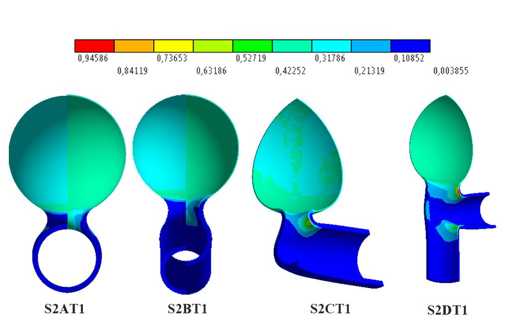 Obrázek 10.7: Rozdíly v topologii napětí. S2AT 1 a S2BT 1 jsou vyobrazeny ze dvou složených pohledů. Zobrazené modely jsou získané geometrie. [M P a] 10.1.2 Vliv úhlu cévy Protože modely u obou skupin mají různý sklon cévy vůči výduti, je vhodné tento jev vyhodnotit.