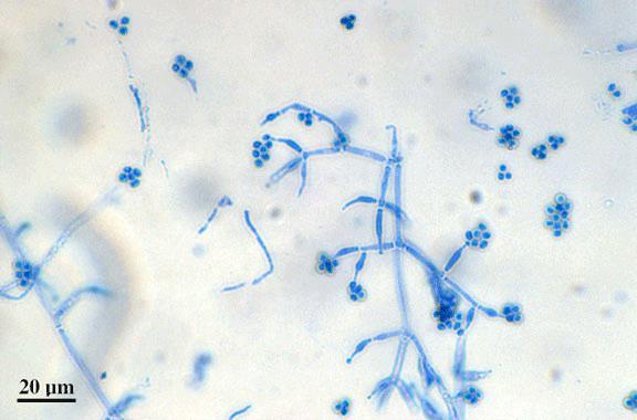 Trichoderma spp.