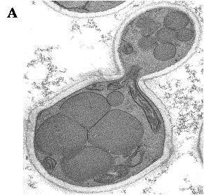 Příklady dalších kvasinek využívaných v biotechnologiích SACCHAROMYCOPSIS LIPOLYTICA (syn.