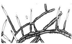 Phaeomoniella chlamydospora (W. Gams, Crous, M. J. Wingf. & L.