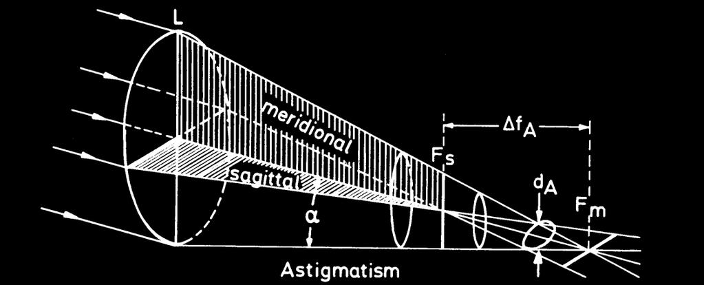 Astigmatismus nesymetrická fokusace čočkou bod se zobrazí jako protáhlá úsečka (elipsa) nutná