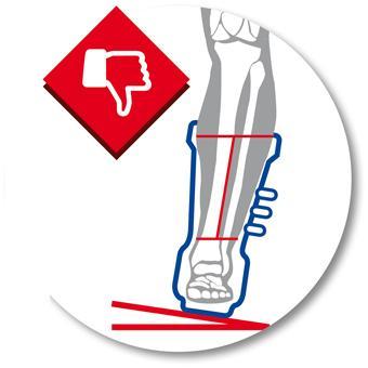 Úpravou canting po meraní odklonu sa komín lyžiarky prispôsobí sklonu predkolenia. Zabezpečí sa správne postavenie chodidla a predkolenia voči podložke.