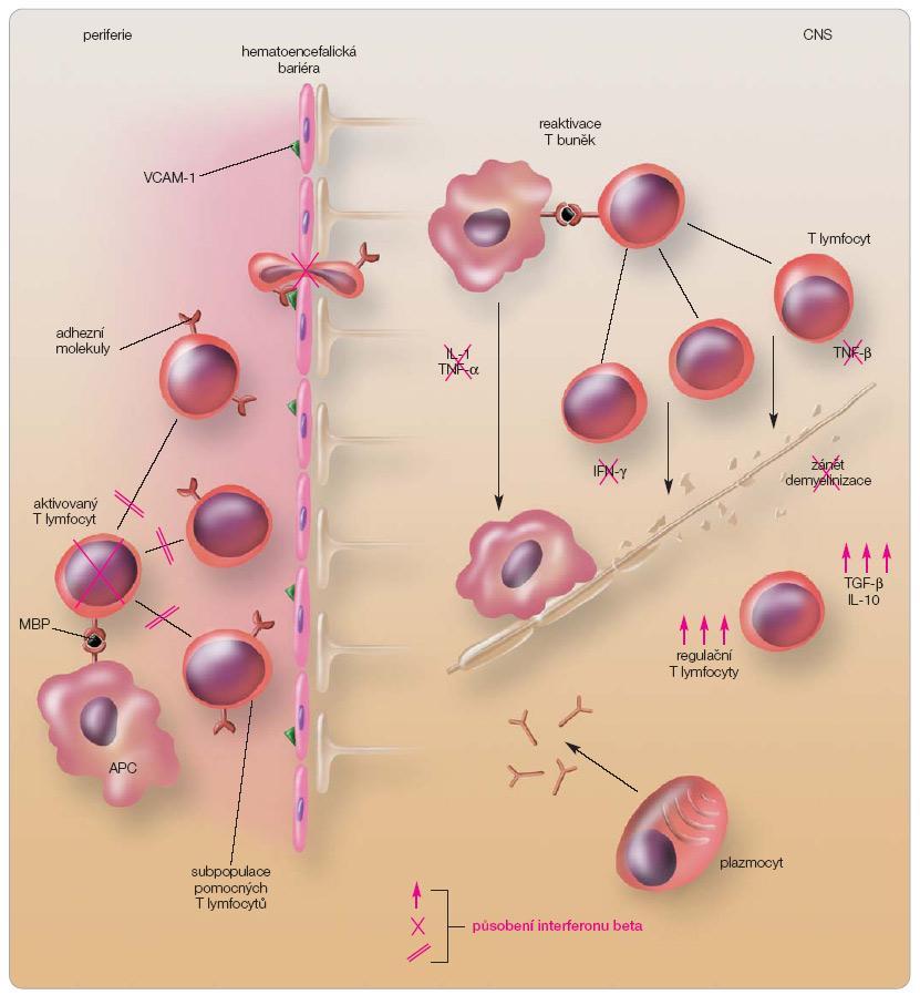 Obr. 4 Mechanismus účinku interferonu beta. T lymfocyty se aktivují na periferii rozpoznáním antigenu předkládaného makrofágem, množí se a prostupují HEB.