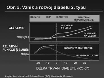 Dvojí porucha: Diabetes typu II Porucha funkce inzulinu - inzulinová rezistence Porucha funkce β-buněk pankreatu - funkční defekty sekrece inzulinu Diabetes typu II Porucha funkce β-buněk pankreatu