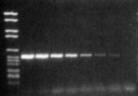 DNA polymeráza za. Obvyklá koncentrace je 0,5 2,5 jednotek / 50 µl. ph je dané reakčním m pufrem, obvykle odpovídá ph 8,3 9,0.