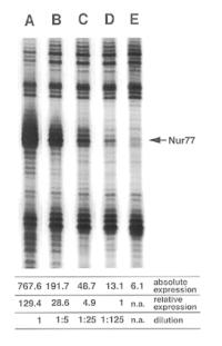 DD-PCR, Differential Display-PCR V genomech obratlovců existuje cca 100 000 strukturních genů V jednotlivých tkáních je exprimováno pouze malé procento z nich DD-PCR slouží pro studium úrovně exprese