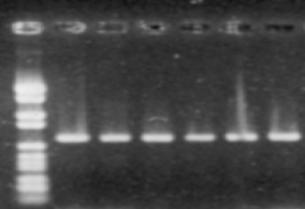 PCR-RFLP Amplifikace známé sekvence se dvěma specifickými primery Cílová sekvence (obvykle určit itého genu) o délce d 1 aža 2 kb je