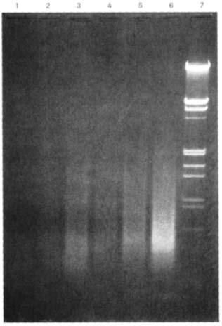 PCR s degenerovanými oligonukleotidovými primery (DOP-PCR) DOP (degenerate( oligonucleotide primer) PCR slouží pro uniformní náhodnou amplifikaci DNA pokud je k dispozici pouze malé množstv ství