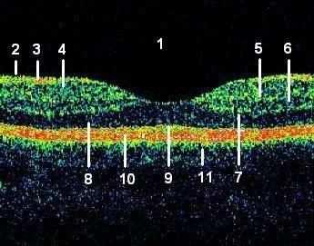 V oftalmologii OCT slouží především k vyšetření makuly, papily z.n. a vrstvy nervových vláken, s tím, že umožňuje zobrazení tkání do hloubky 2 mm vzhledem k pohlcení světla.