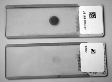 laboratorní technologie kladního barvení, a to barvení na automatickém hematologickém analyzátoru LH750 (Beckman Coulter), manuální barvení používané na našem hematologickém pracovišti [metanol,