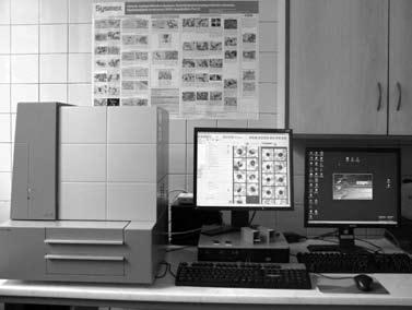 Automatická morfologická analýza buněk v mozkomíšním moku pomocí digitální mikroskopie CellaVision TM DM 96 laboratorní technologie J. Ženková, K. Bršlicová, V.