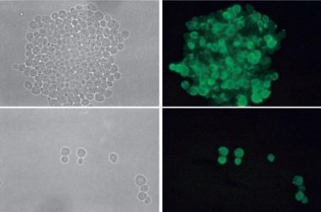 knihovny lidských cdna (i protilátek z pacientů) - využití i pro biotechnologie