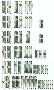 Genómové mutácie 41 a) 2n b) 2n-2 nulizomik 2n-1 monozomik 2n-1-1 dvojitý monozomik 2n+1 trizomik 2n+2 tetrazomik 2n+2+2 dvojitý tetrazomik Obr. 4.2 Kompletná chromozómová diploidná sada a príklady aneuploidie.
