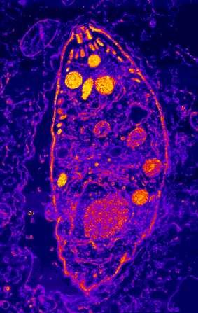 Kokcídia mačacia (Toxoplasma gondii) V mačkovitýchšelmách, človek se môže