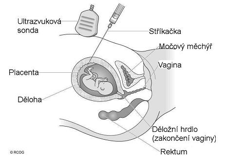 Příloha č. 5 - CVS http://www.