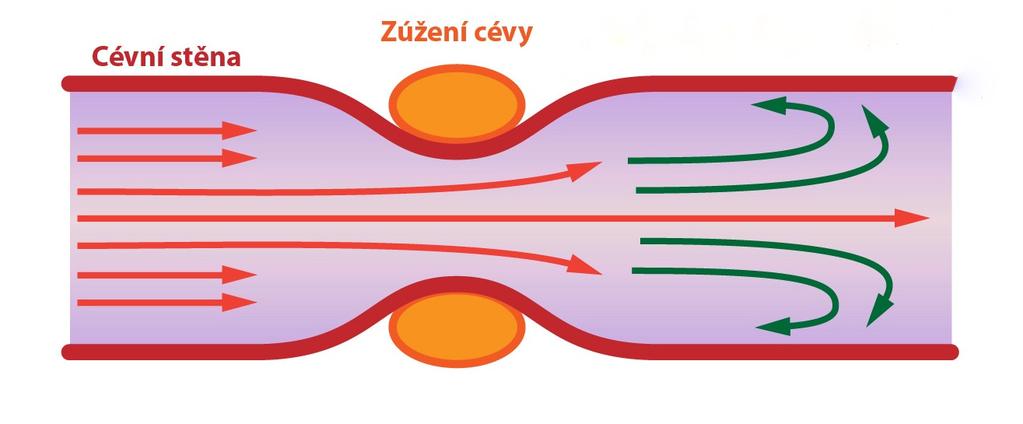 Přechod mezi laminárním a turbulentním prouděním, na obr. 1.5, popisuje Reynoldsovo číslo Re, které je dáno vzorcem [2]: Re = r v ρ η [ ], (1.