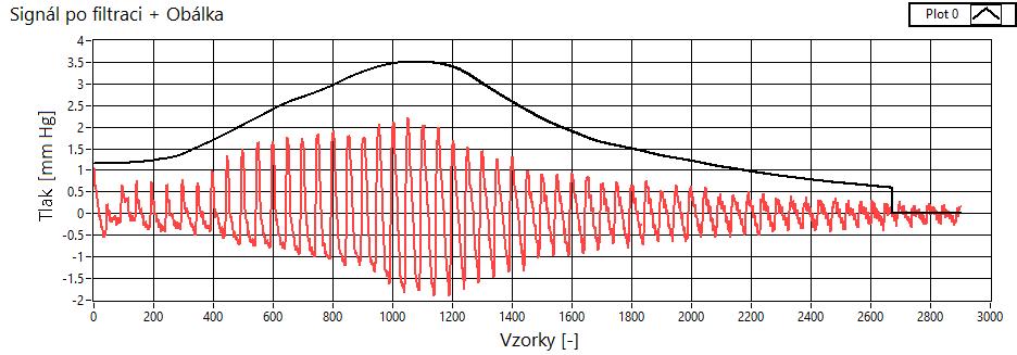 Obr. 3.21: Vyfiltrovaný signál a jeho obálka 3.2.4 Algoritmus výpočtu ST a DT Po vytvoření obálky následuje samotný algoritmus výpočtu tlaků.